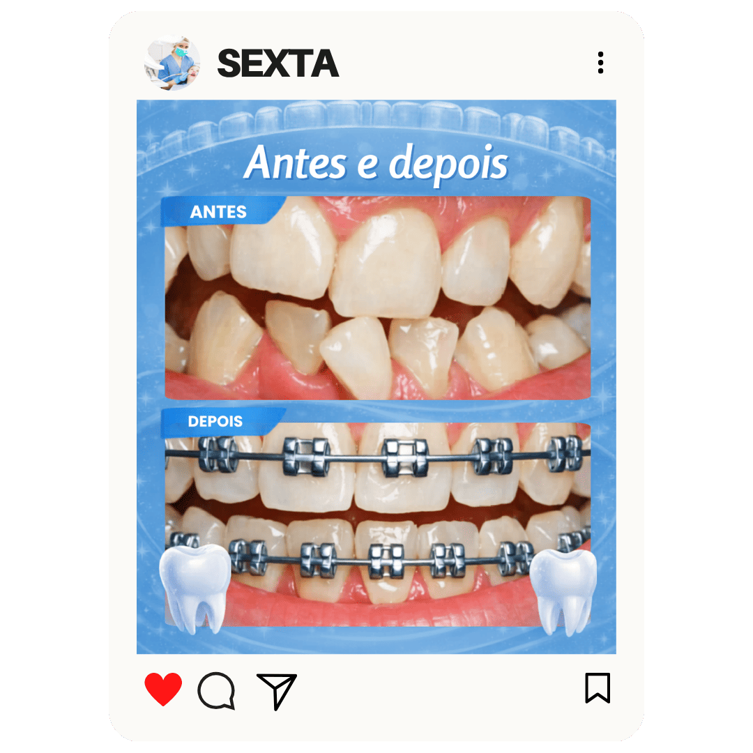 CAPA DOS PRODUTOS CLUB (52)